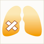 慢性閉塞性肺疾患
