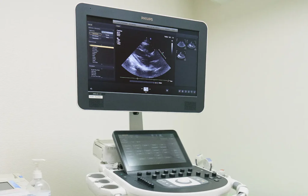 超音波診断装置（エコー装置）